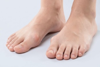 外反母趾傾向が気になる方へ｜足にやさしいサンダルとは？