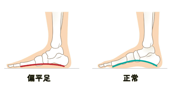 土踏まず
