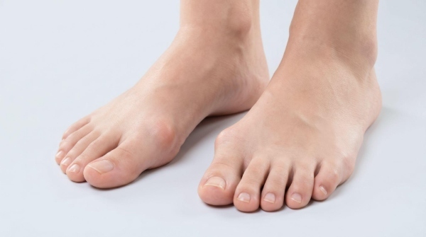 外反母趾傾向が気になる方へ｜足にやさしいサンダルとは？