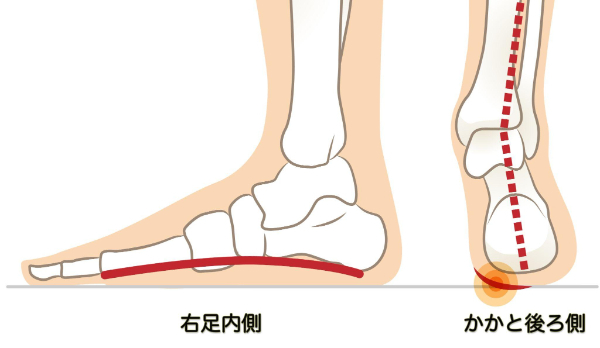 土踏まず